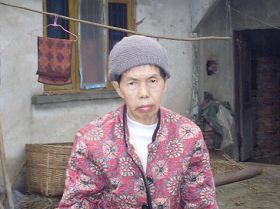 '谭金会发病前(左)和发病后(右)的照片。'