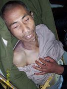 自2009年2月25日被绑架到2009年10月25日被迫害致死,年仅46岁的黄立忠被折磨得皮包骨、伤痕累累。