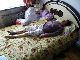 宋会兰被打毒针迫害后,腿脚变黑、小腿腐烂。(明慧网)