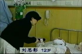 中共利用十二岁的小女孩刘思影的生命来煽动仇恨,然而在央视“自焚”节目的镜头中:“自焚”中严重烧伤的小女孩刘思影,气管切开后很快就能说话、唱歌,完全违背医学常理。