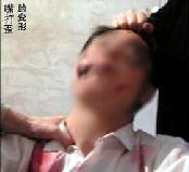 酷刑演示:嘴打歪