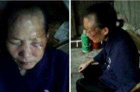 '谭翠英遭国保警察暴打后的照片,老人双目紧闭,伤痕累累。'