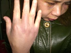 '在洗脑班,杨兰珍的手被打肿'