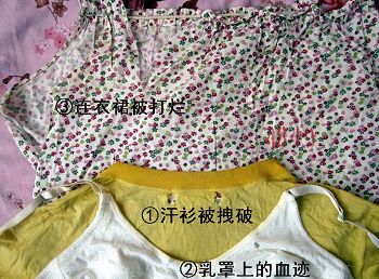 '(1)汗衫被拽破;(2)鲜血染红了外衣渗透到乳罩上;(3)打烂的连衣裙。'
