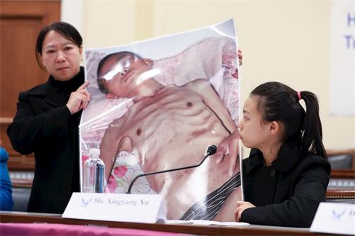 '图4:今年十七岁的徐鑫洋和妈妈迟丽华在美国国会展示了一幅她的爸爸徐大为被中共迫害得瘦骨嶙峋,满身伤痕,奄奄一息的照片。'