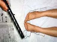 '酷刑示意图:用电针电击'