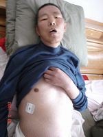 '栾福生在晋中监狱被迫害的全身浮肿,生命垂危时送回家,十九天后含冤离世'