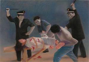 '酷刑:打毒针
