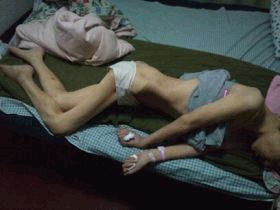 '刘志被迫害的照片(2013年回家后照)'