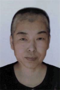 '法轮功学员李国俊(被迫害化疗后)'