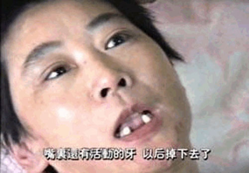 图10:恶警和犯人用木棒把李萍的牙齿撬掉多颗