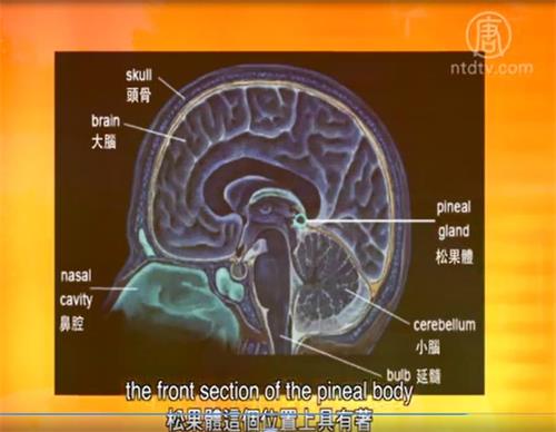 '图2:现在医学上已经证实的松果体。'