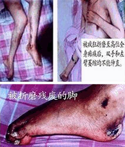被折磨成残废的身驱
