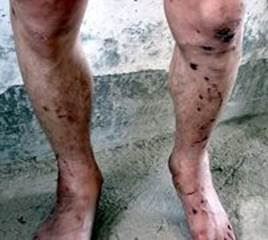 '本人腿部多处被打坏,左脚摔伤不能着地'