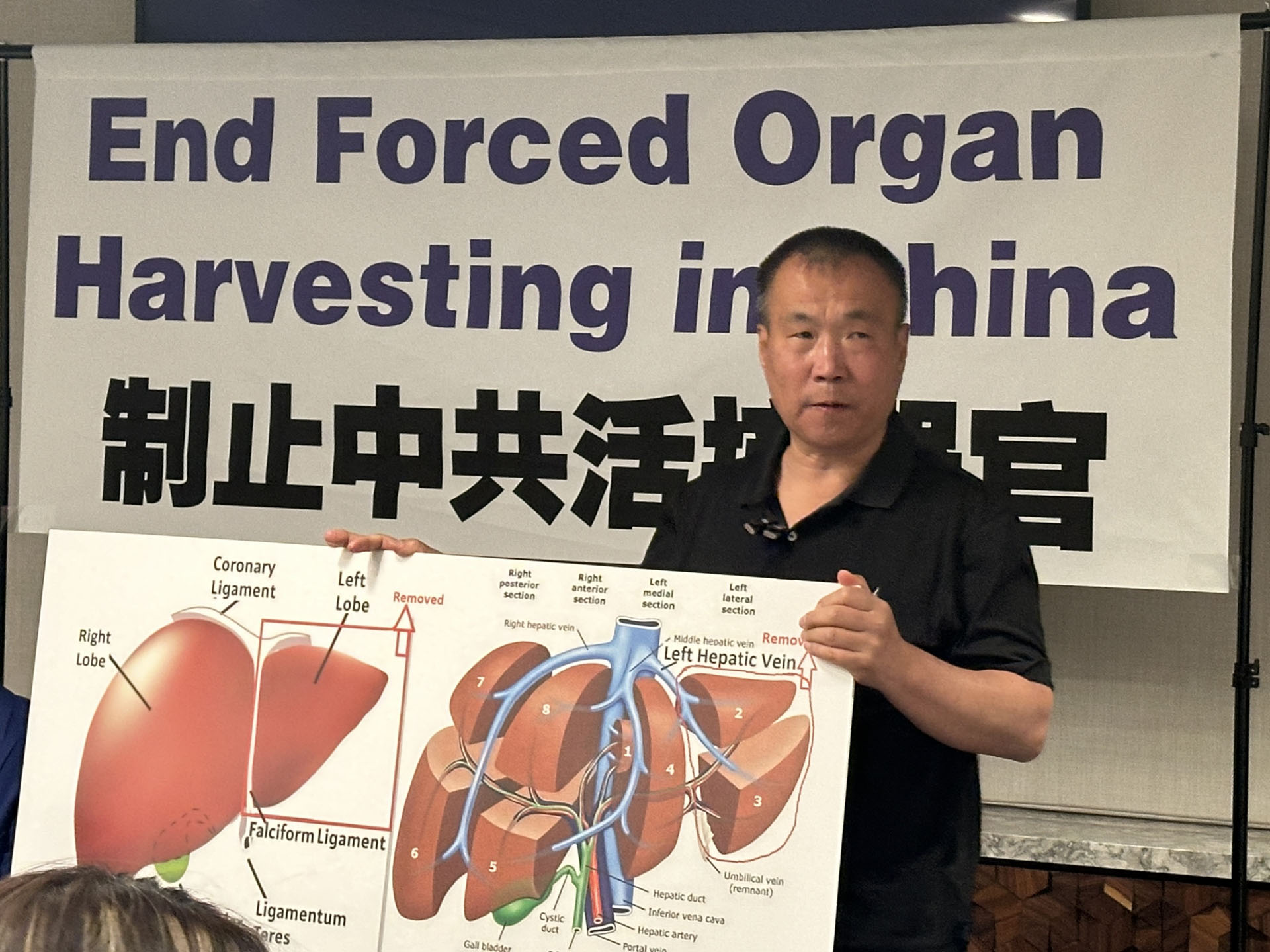 图1:二零二四年七月三日下午,来自中国大陆的法轮功学员程佩明在美国首都华盛顿举办的记者会上讲述了遭受中共关押,酷刑迫害,以及被活摘器官的亲身经历。